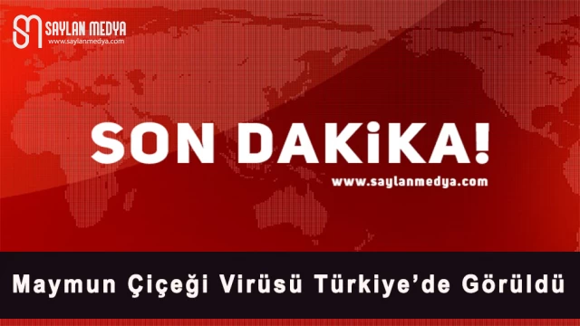 Maymun Çiçeği Virüsü Türkiye'de!..